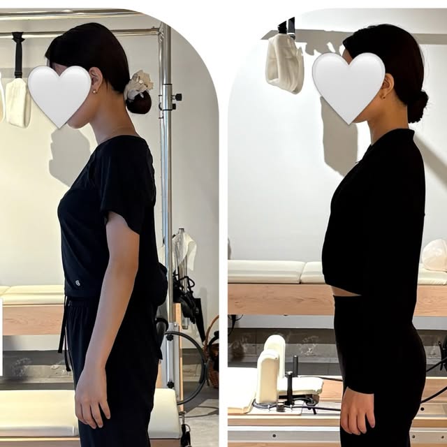 Before After 姿勢の比較